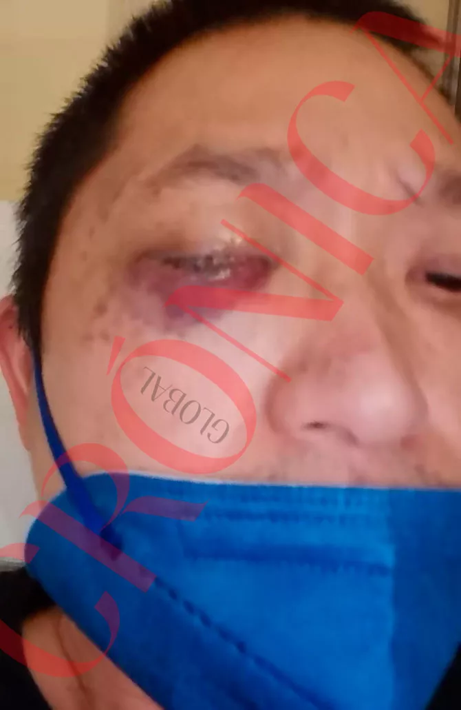 agresor-granollers-restaurador