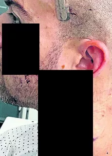 agresion-policia-uribarri