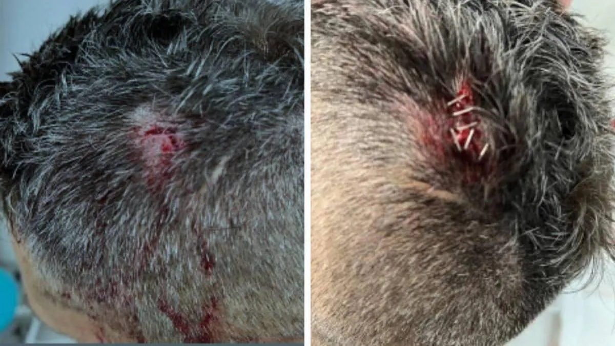 agresion-policia-valencia