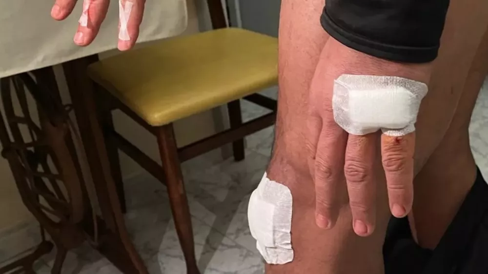 EB1EA4B5-960F-4F12-82B1-4FA073D588B4